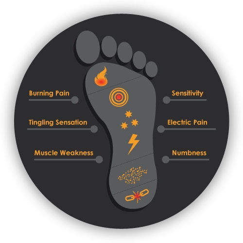 Chiropractic Missoula MT Neuropathy Foot