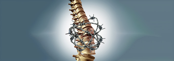 Illustration of a human spine wrapped tightly in barbed wire, symbolizing chronic back pain, spinal compression, nerve irritation, and restricted mobility against a blue gradient background.