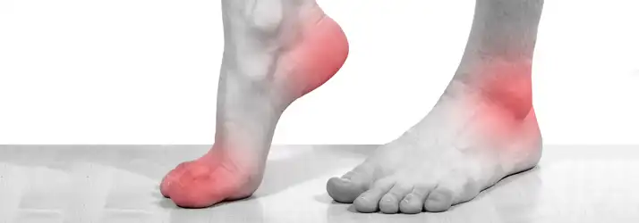 Close-up illustration of two feet with red highlighted areas on the heel, ankle, and ball of the foot, representing foot pain, plantar fasciitis, inflammation, neuropathy, or chronic discomfort.